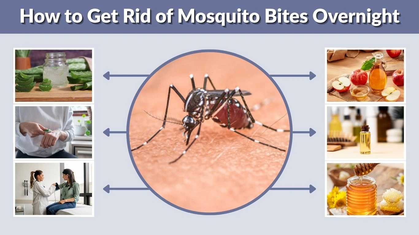 How to Get Rid of Mosquito Bites Overnight: Fast Relief, Home Remedies & Tips