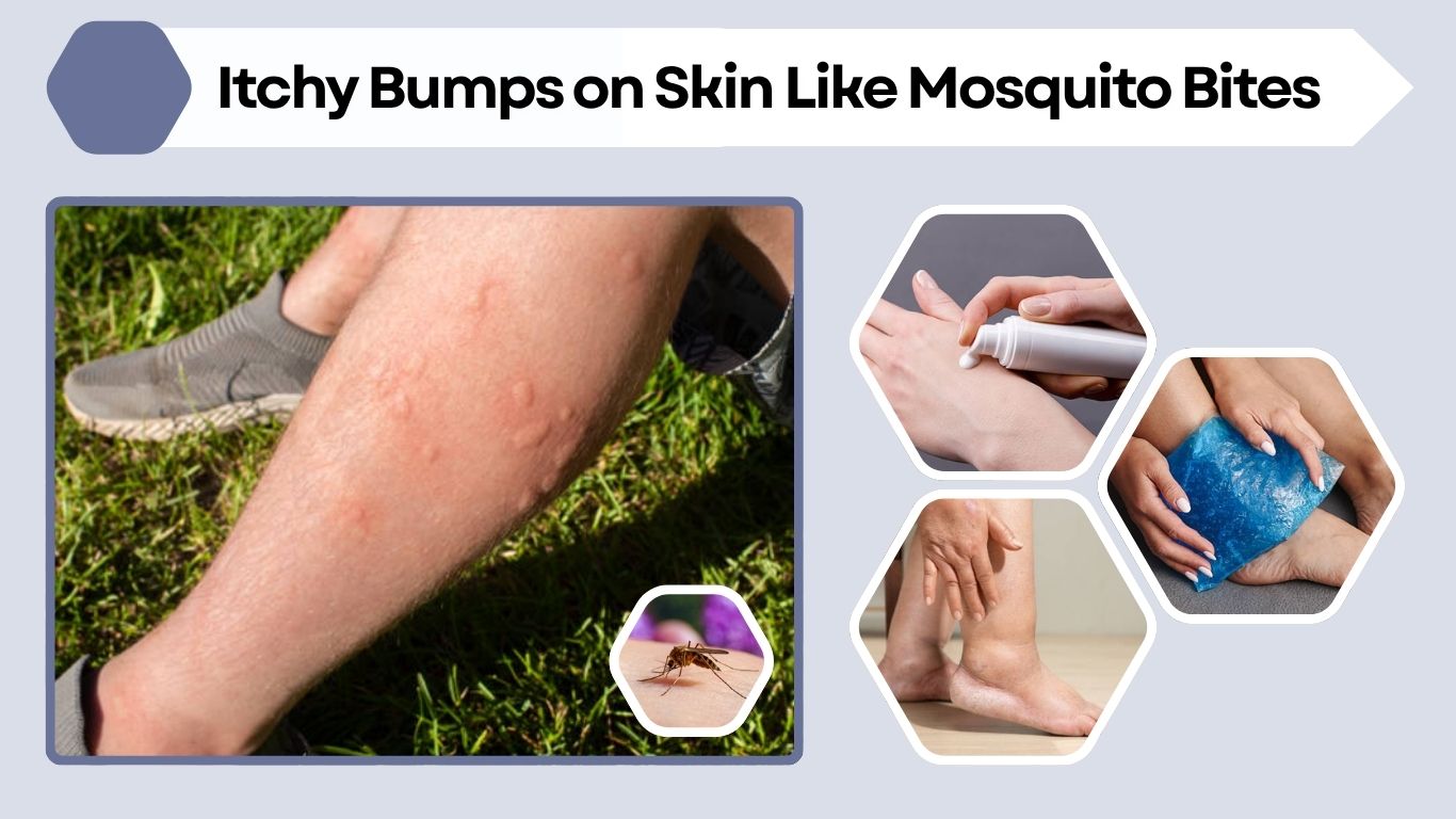 Itchy Bumps on Skin Like Mosquito Bites but Aren’t: Causes & Symptoms