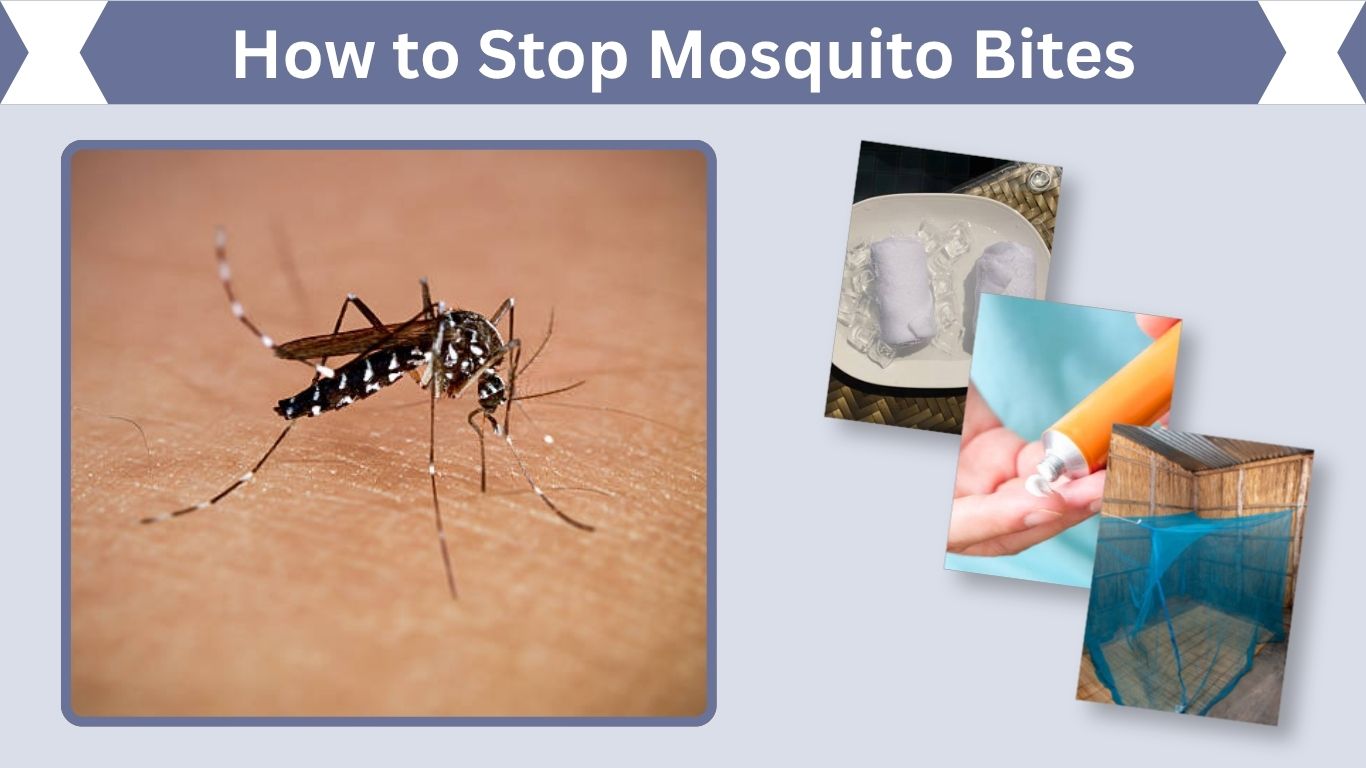 How to Stop Mosquito Bites From Itching Fast