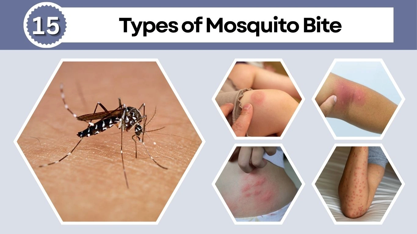 Mosquitoadv.com
