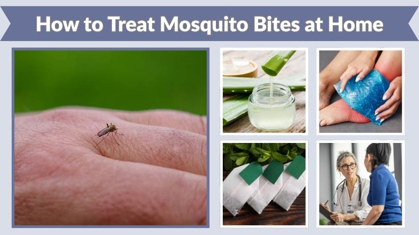 How to Treat Mosquito Bites at Home: Easy Step-by-Step Guide