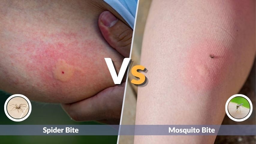Spider Bite vs Mosquito Bite: Symptoms and Treatment
