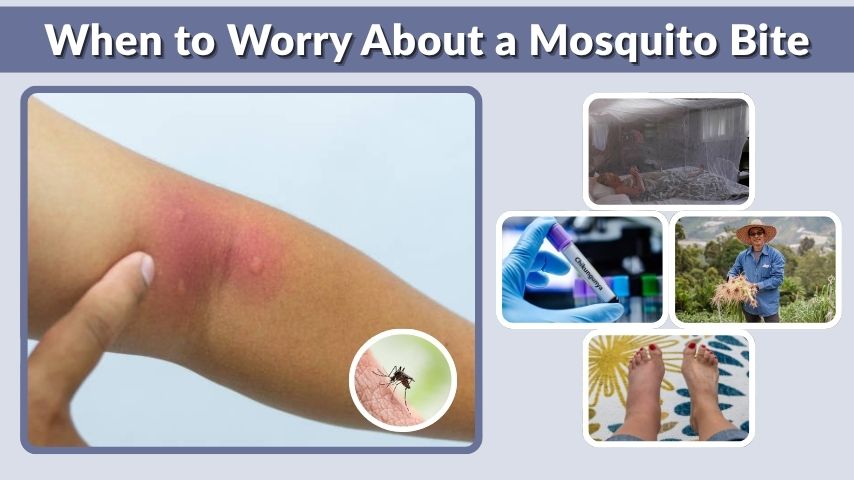 When to Worry About a Mosquito Bite: Causes and Warning Signs