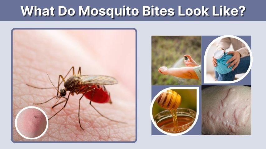 What Do Mosquito Bites Look Like? Identification Guide