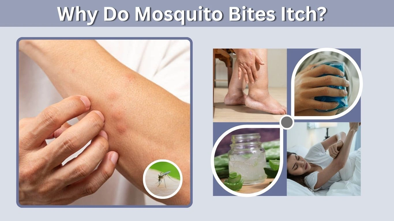 Why Do Mosquito Bites Itch? Causes, Swelling, Nighttime Itching & Relief