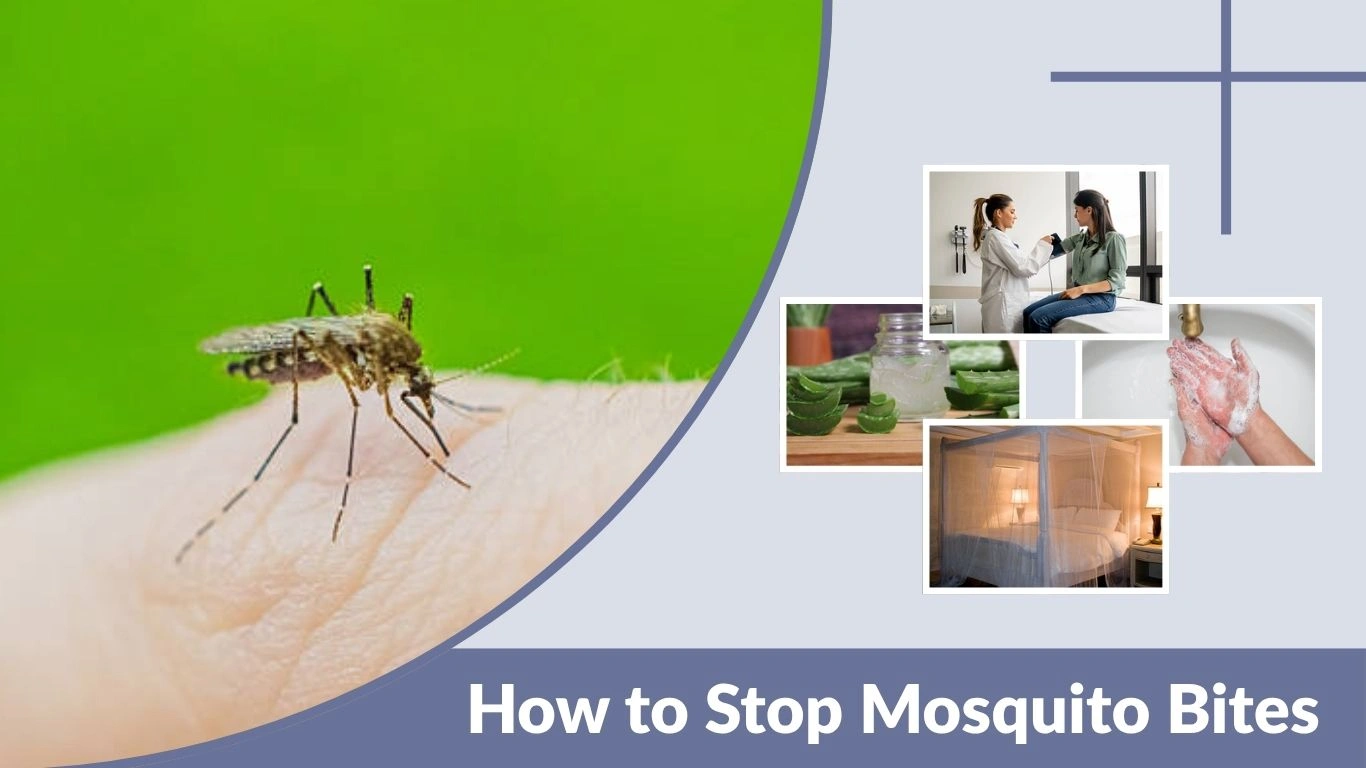 How to Stop Mosquito Bites from Itching: Step-by-Step Relief 