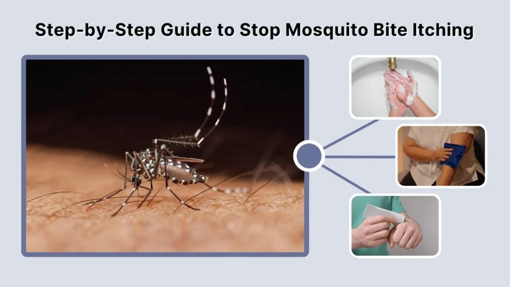Step-by-Step Guide to Stop Mosquito Bite Itching