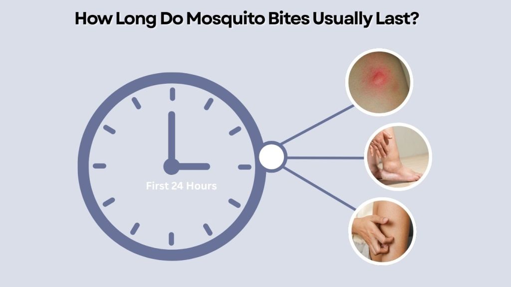 How Long Do Mosquito Bites Usually Last?