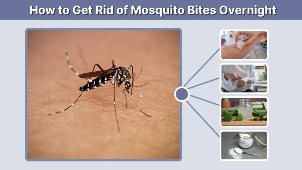 How to Get Rid of Mosquito Bites Overnight (Fast Methods)