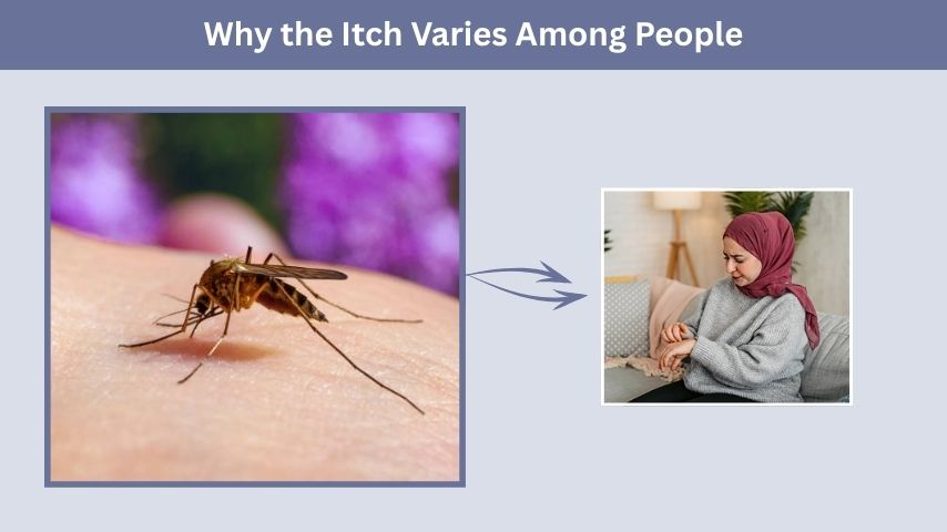 Why the Itch Varies Among People