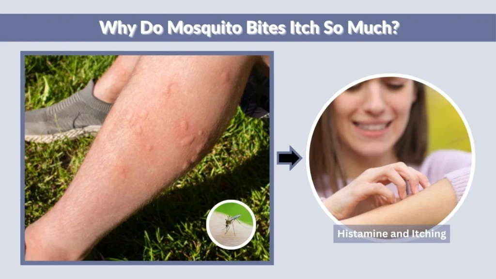 Why Do Mosquito Bites Itch So Much?