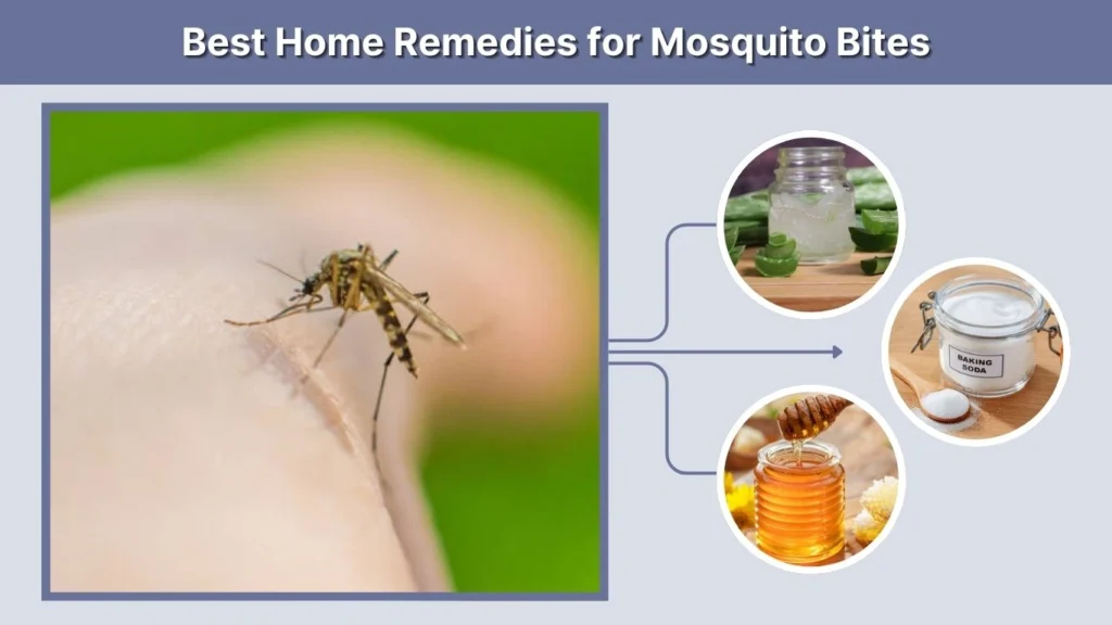 Best Home Remedies for Mosquito Bites