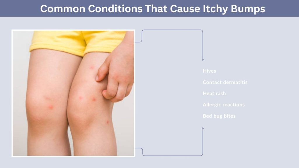 Common Conditions That Cause Itchy Bumps