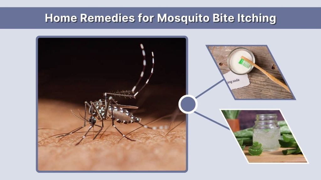 Home Remedies for Mosquito Bite Itching