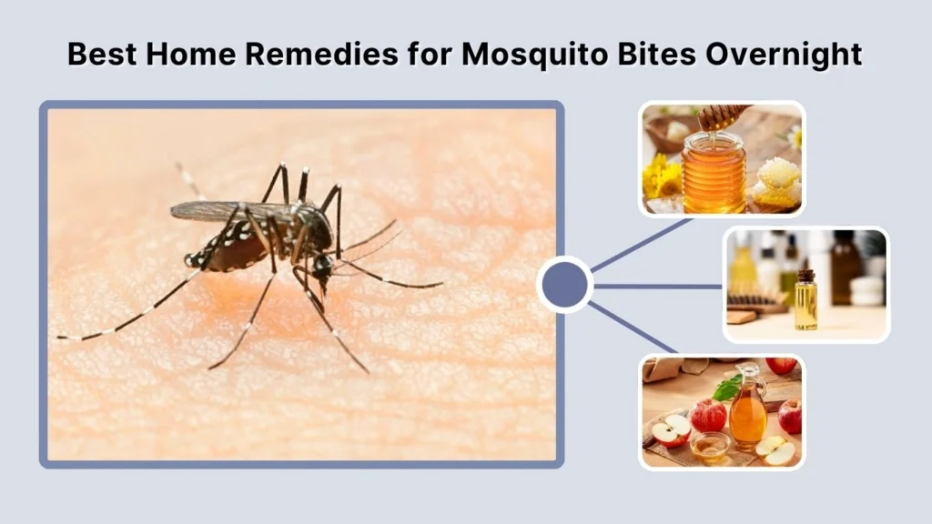 Best Home Remedies for Mosquito Bites Overnight