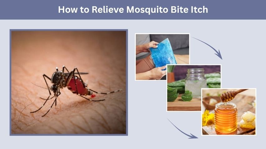 How to Relieve Mosquito Bite Itch