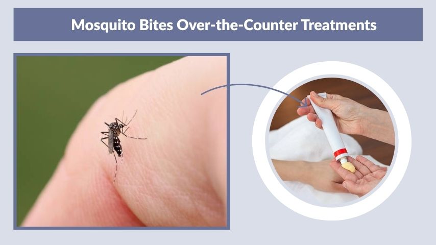 Mosquito Bites Over-the-Counter Treatments