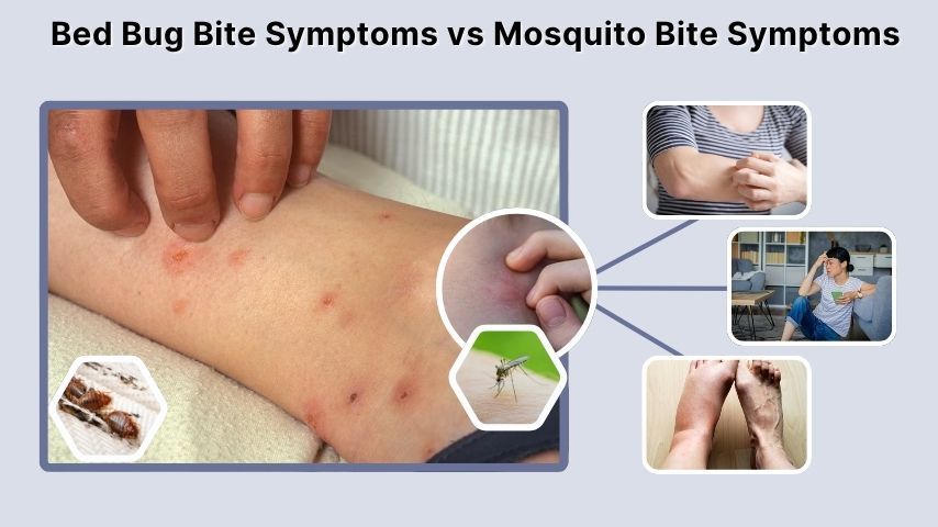 Bed Bug Bite Symptoms vs Mosquito Bite Symptoms