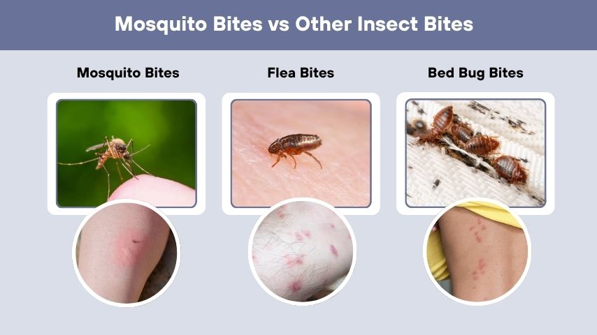 Mosquito Bites vs Other Insect Bites