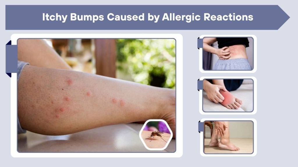 Itchy Bumps Caused by Allergic Reactions