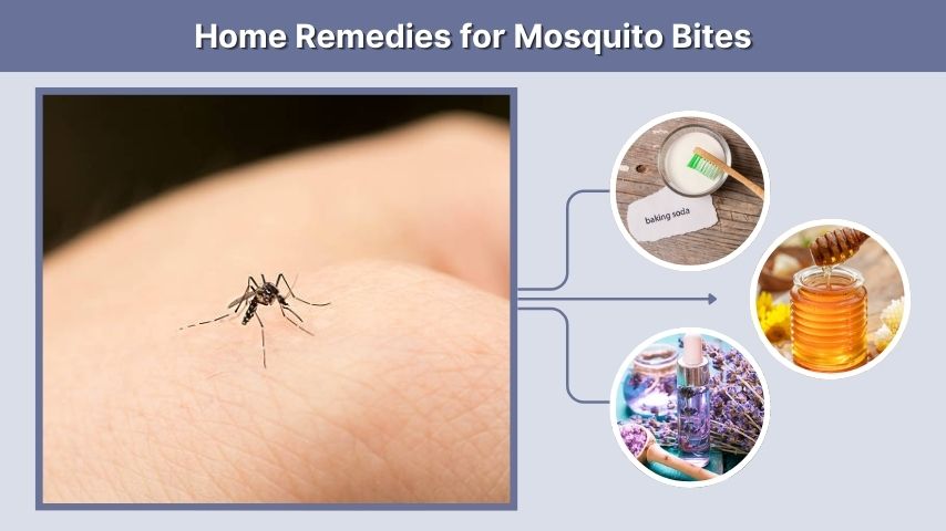 Home Remedies for Mosquito Bites