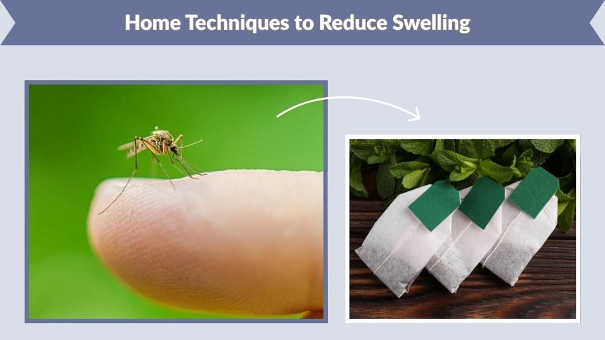 Home Techniques to Reduce Swelling