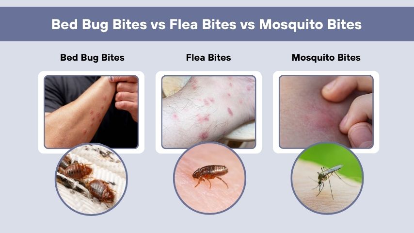 Bed Bug Bites vs Flea Bites vs Mosquito Bites