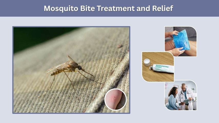 Mosquito Bite Treatment and Relief