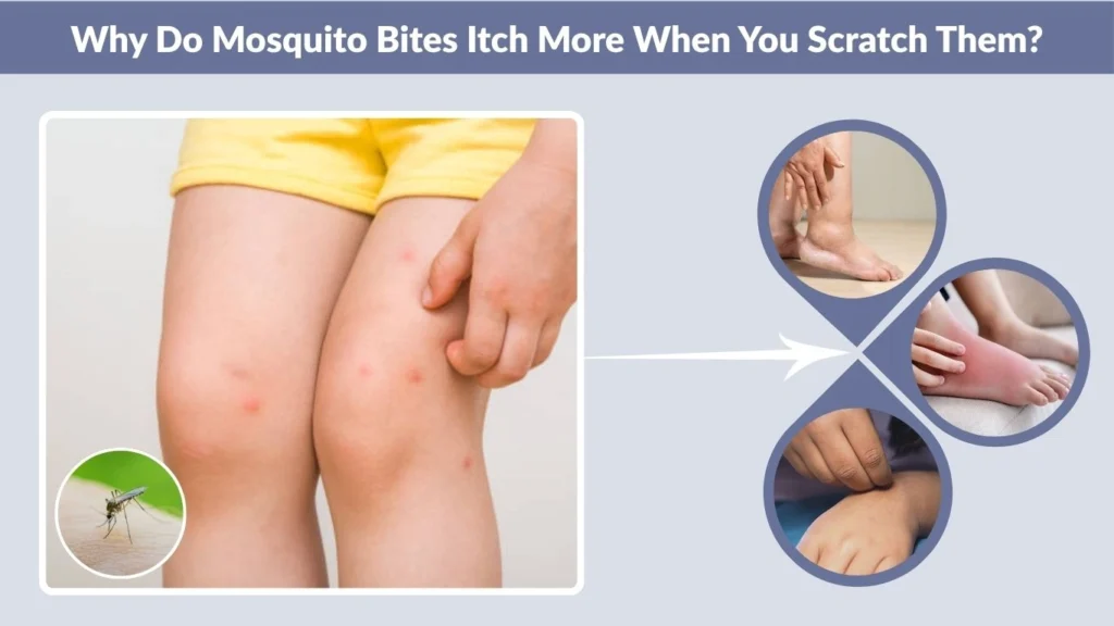 Why Do Mosquito Bites Itch More When You Scratch Them?