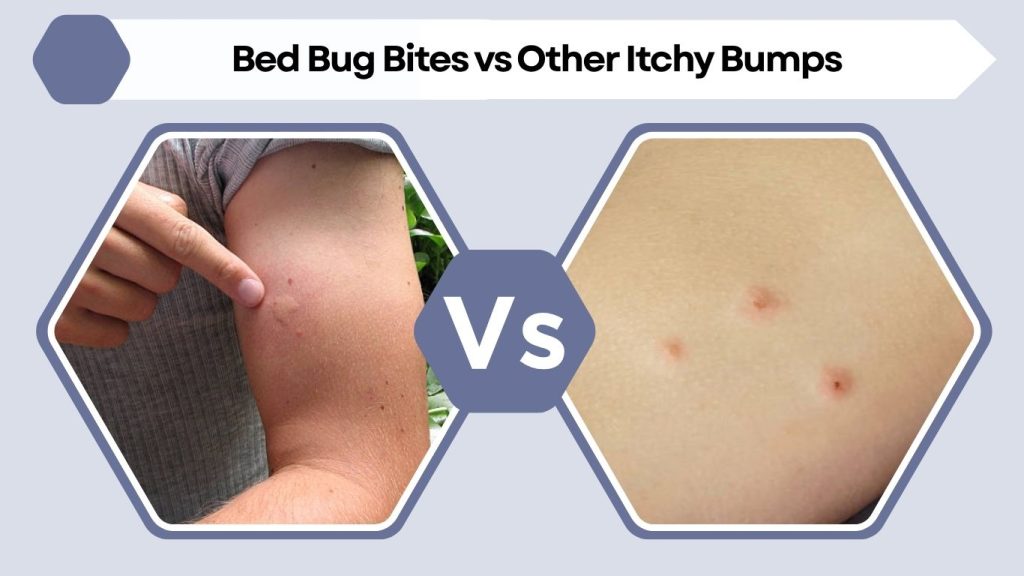 Bed Bug Bites vs Other Itchy Bumps