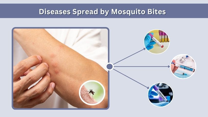 Diseases Spread by Mosquito Bites