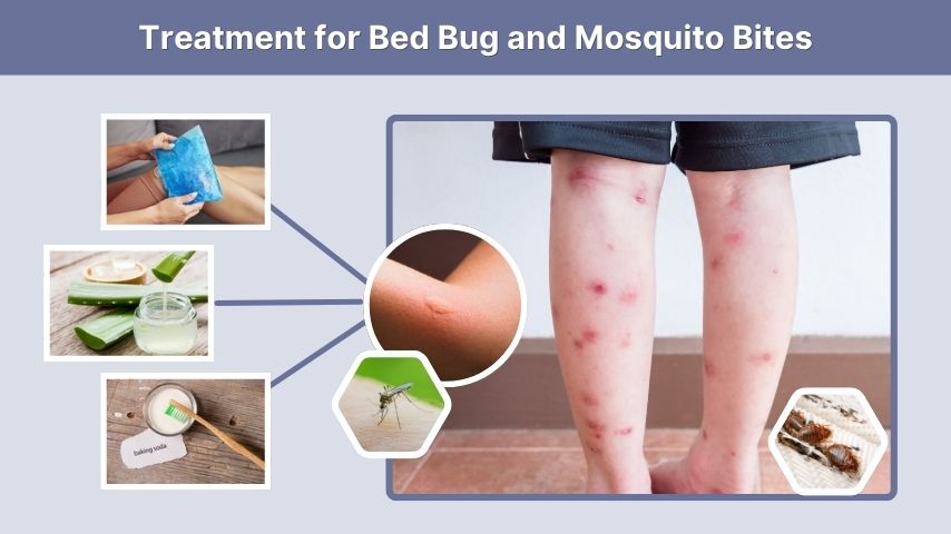 Treatment for Bed Bug and Mosquito Bites