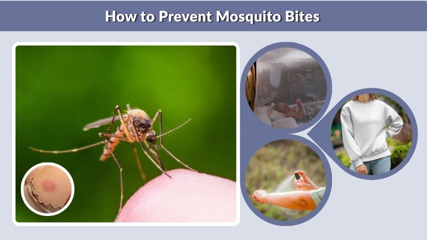 How to Prevent Mosquito Bites