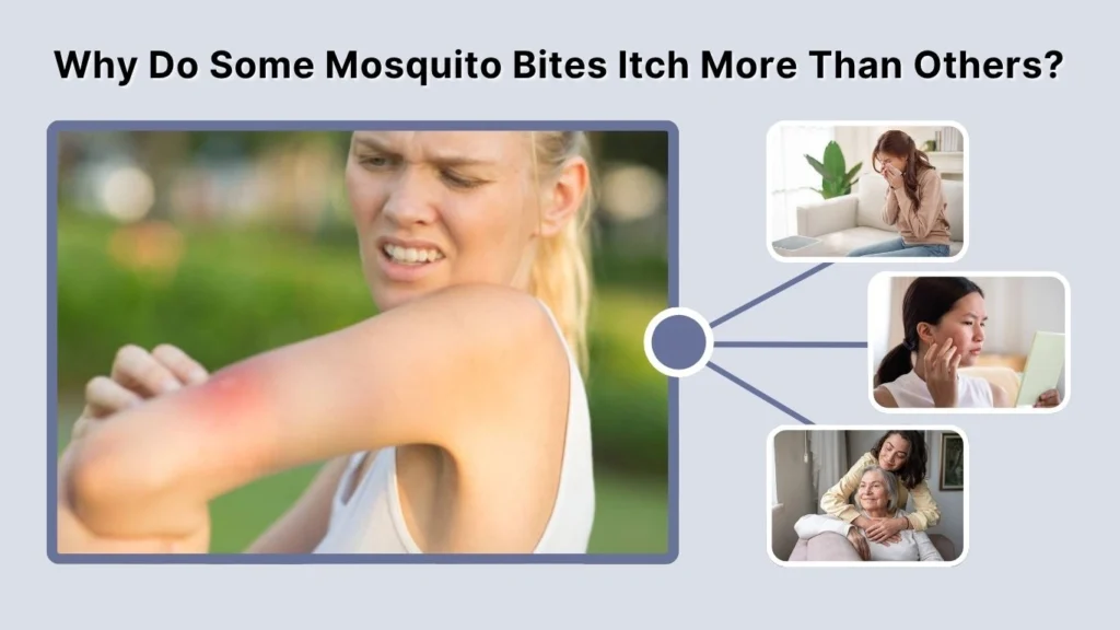 Why Do Some Mosquito Bites Itch More Than Others?
