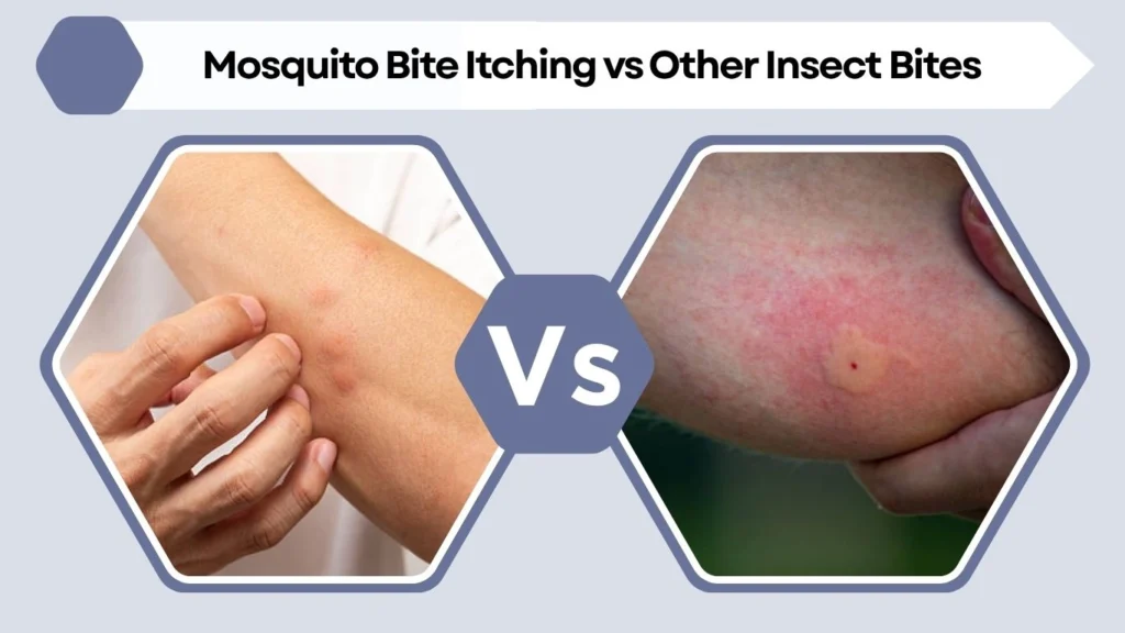 Mosquito Bite Itching vs Other Insect Bites