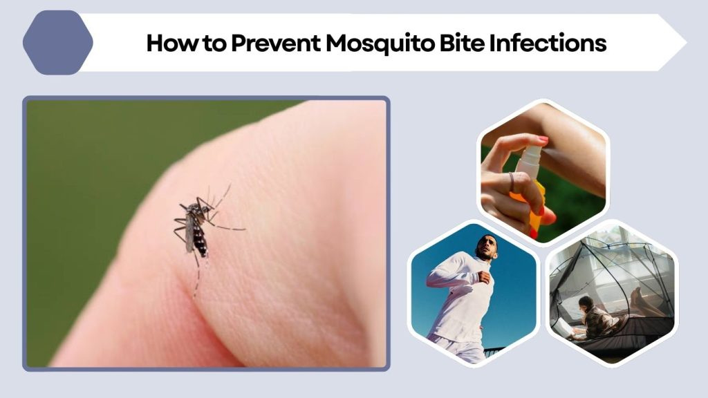 How to Prevent Mosquito Bite Infections