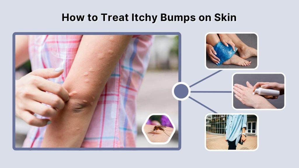 How to Treat Itchy Bumps on Skin
