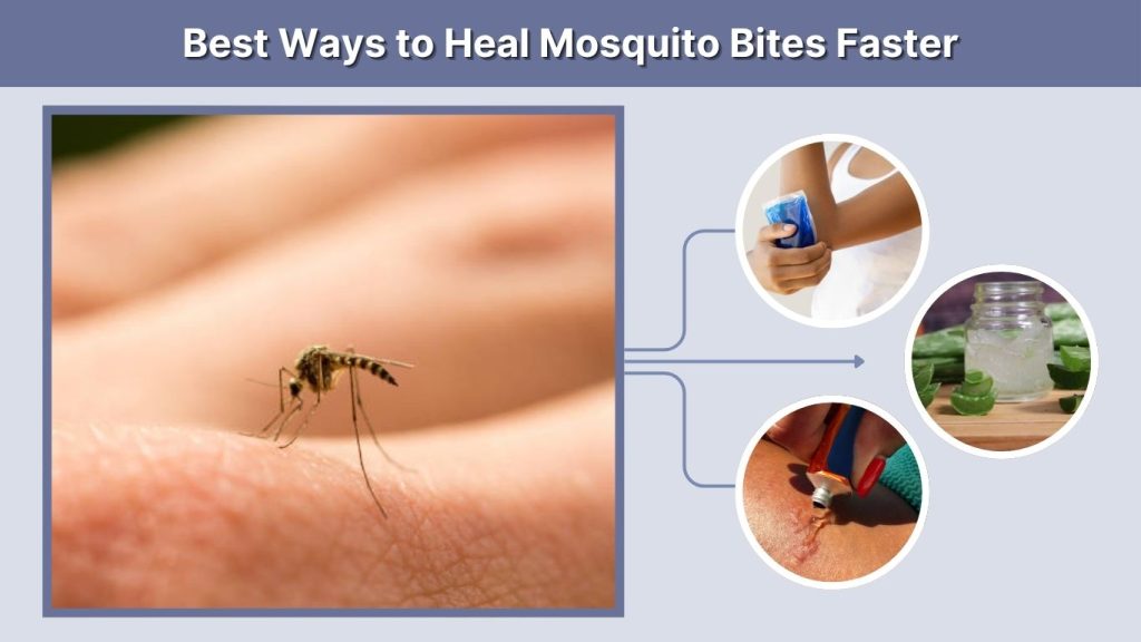 Best Ways to Heal Mosquito Bites Faster