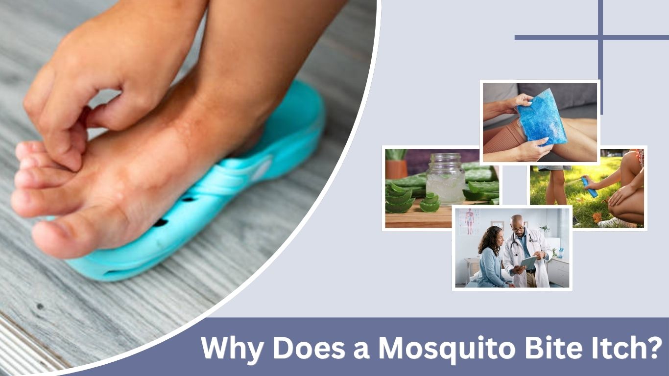 Why Does a Mosquito Bite Itch? Causes, Care, and Protection