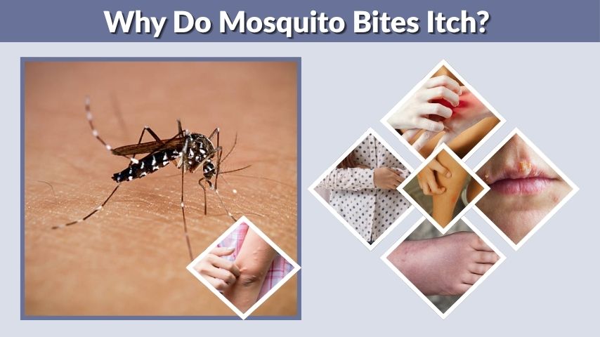 Why Do Mosquito Bites Itch? Causes and Relief Tips