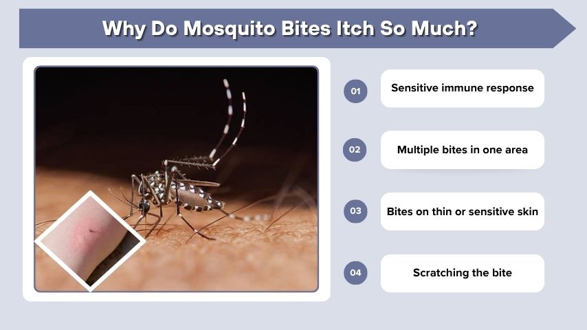 Why Do Mosquito Bites Itch So Much?