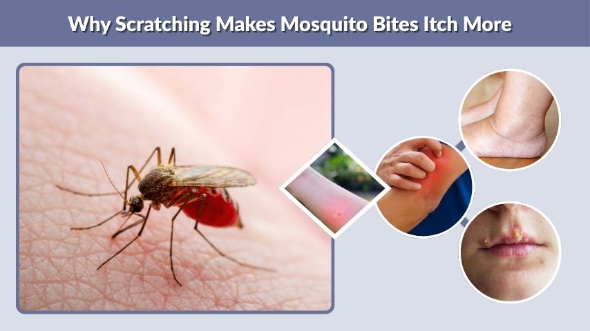 Why Scratching Makes Mosquito Bites Itch More