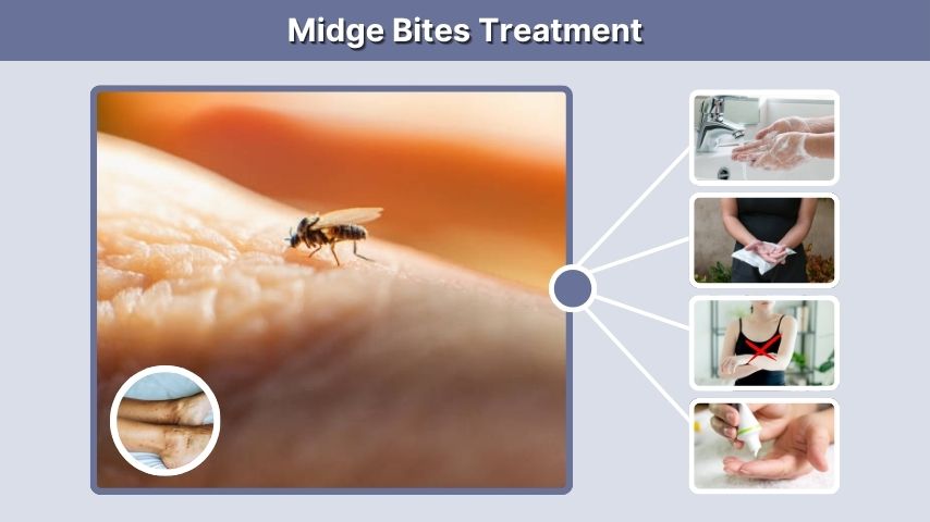 Midge Bites Treatment