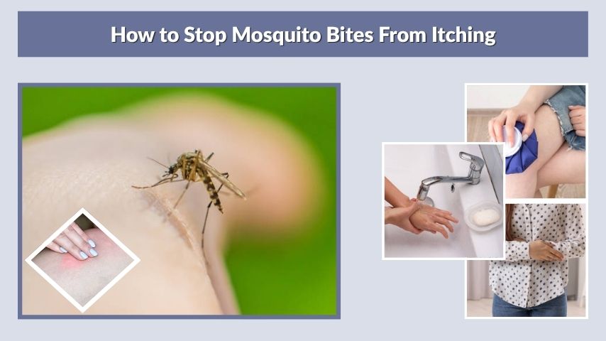 How to Stop Mosquito Bites From Itching