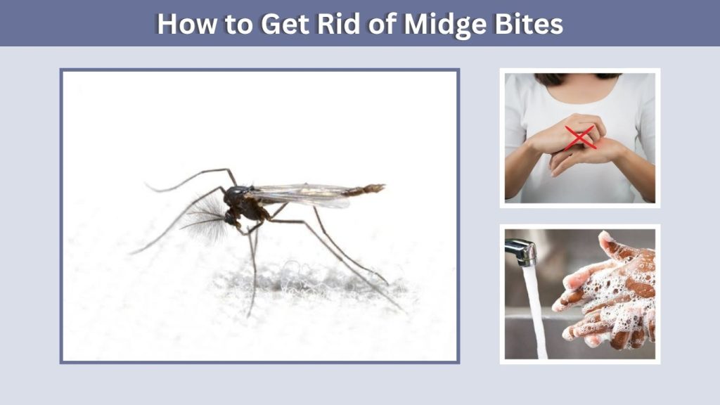 How to Get Rid of Midge Bites