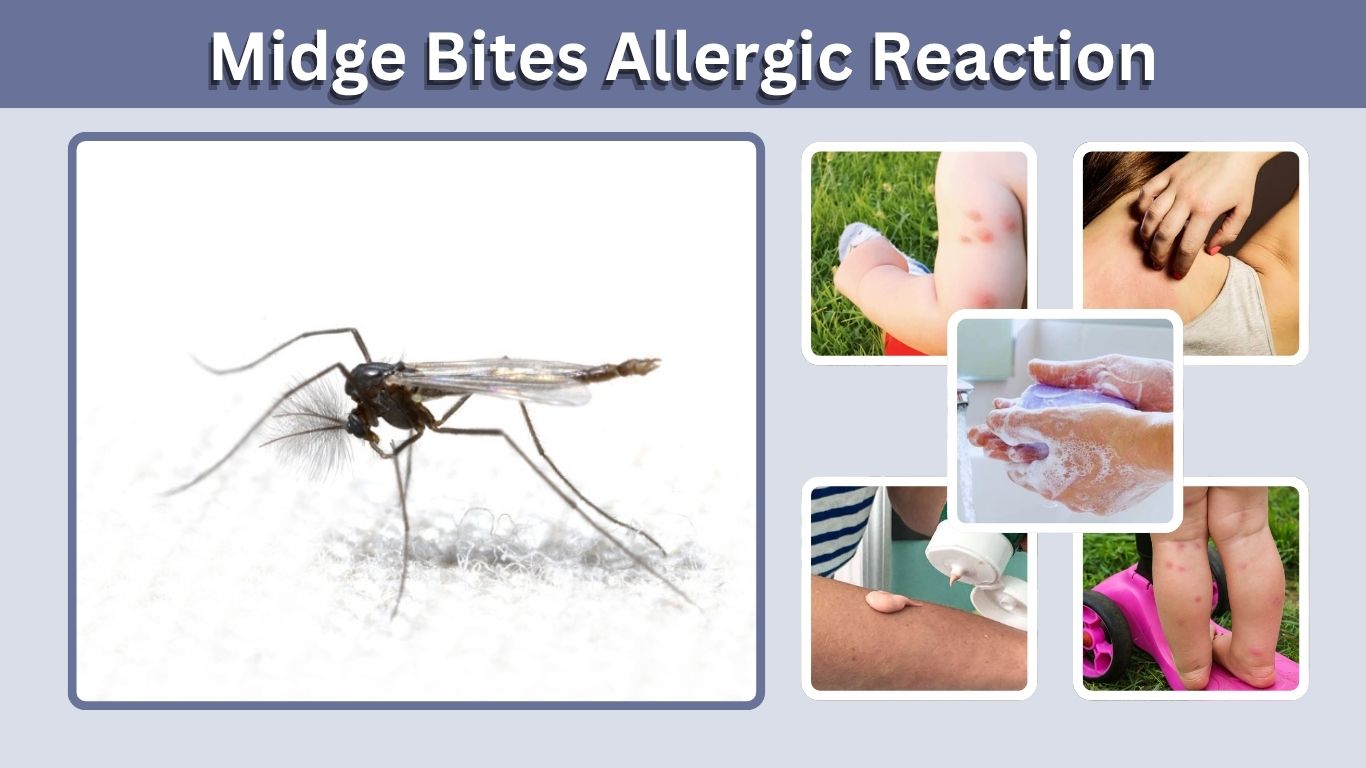 Midge Bites Allergic Reaction: Symptoms and Treatment