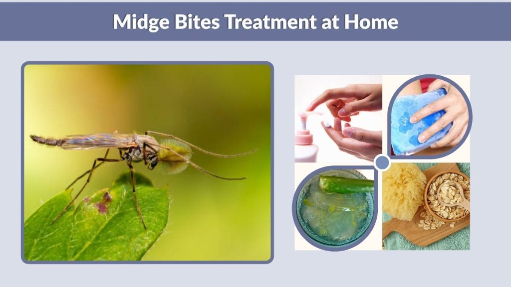 Midge Bites Treatment at Home