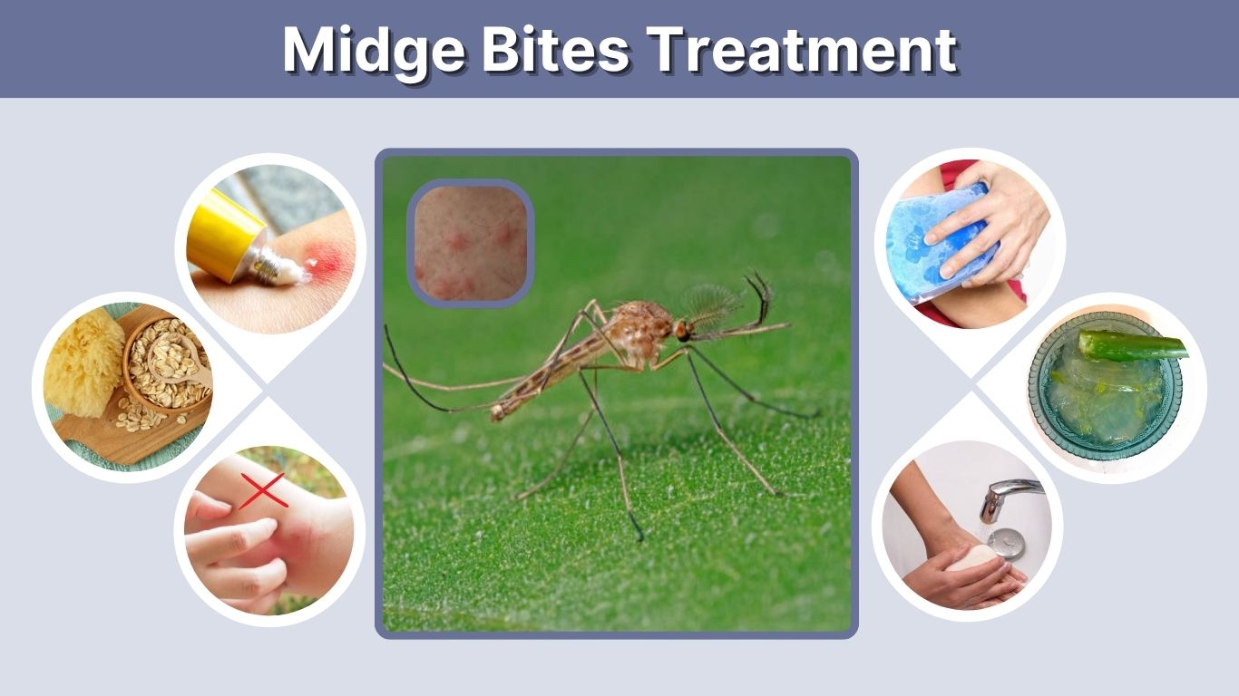 Midge Bites Treatment: Best Remedies, Relief and Prevention