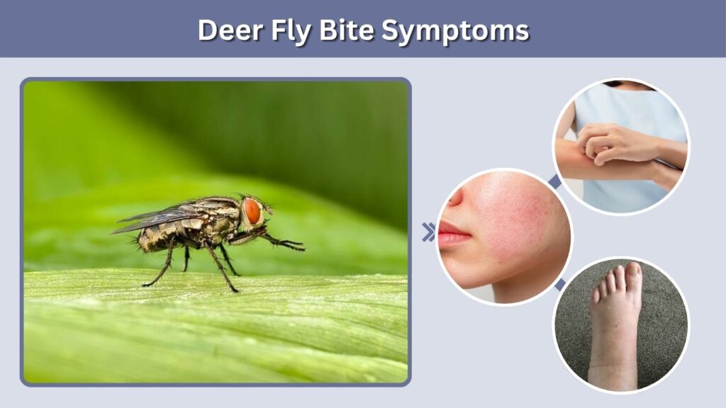 Deer Fly Bite Symptoms