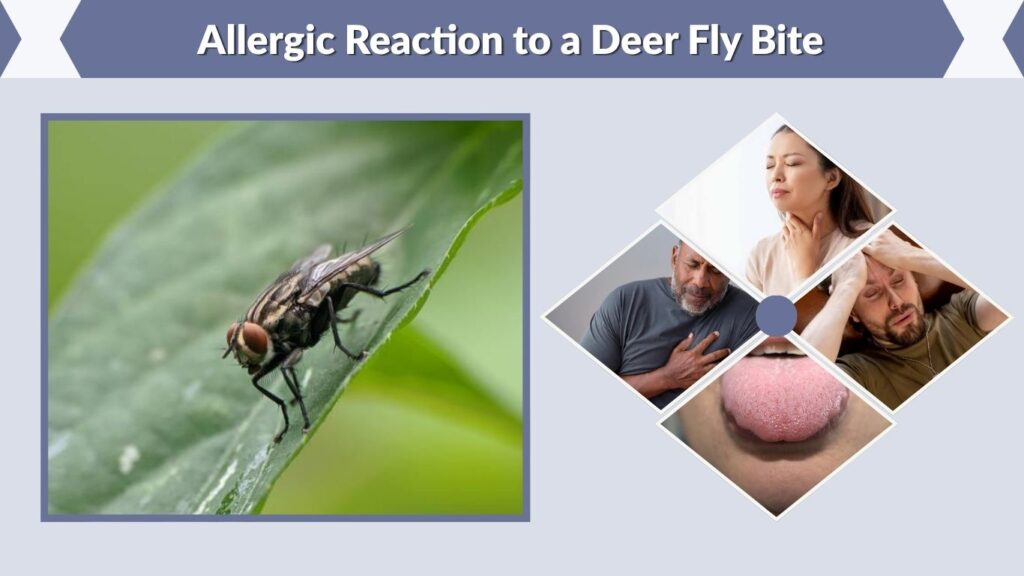 Allergic Reaction to a Deer Fly Bite